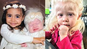 Tohle že je naše dítě? Holčička s albinismem na porodním sále vyděsila maminku!