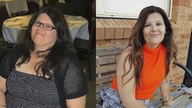 Závislost na fast foodu ji dovedla k obezitě! Díky dietnímu programu má o 30 kilo méně