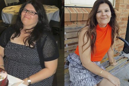 Závislost na fast foodu ji dovedla k obezitě! Díky dietnímu programu má o 30 kilo méně