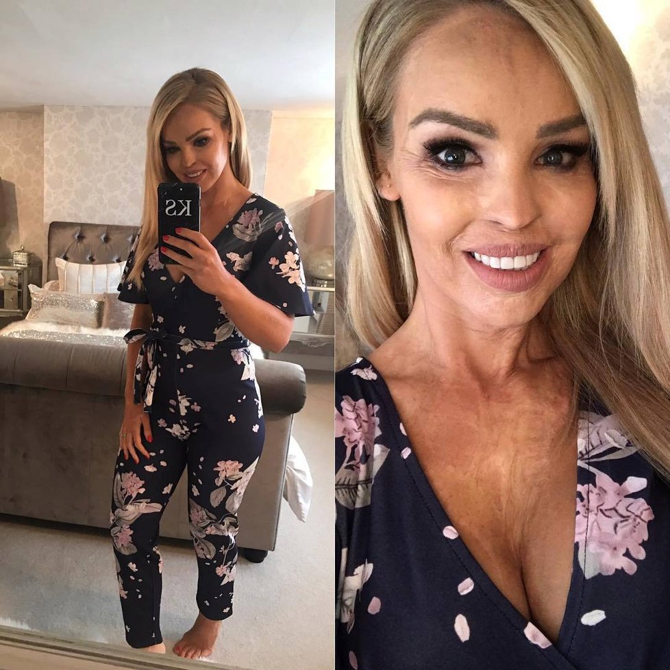 Katie Piper