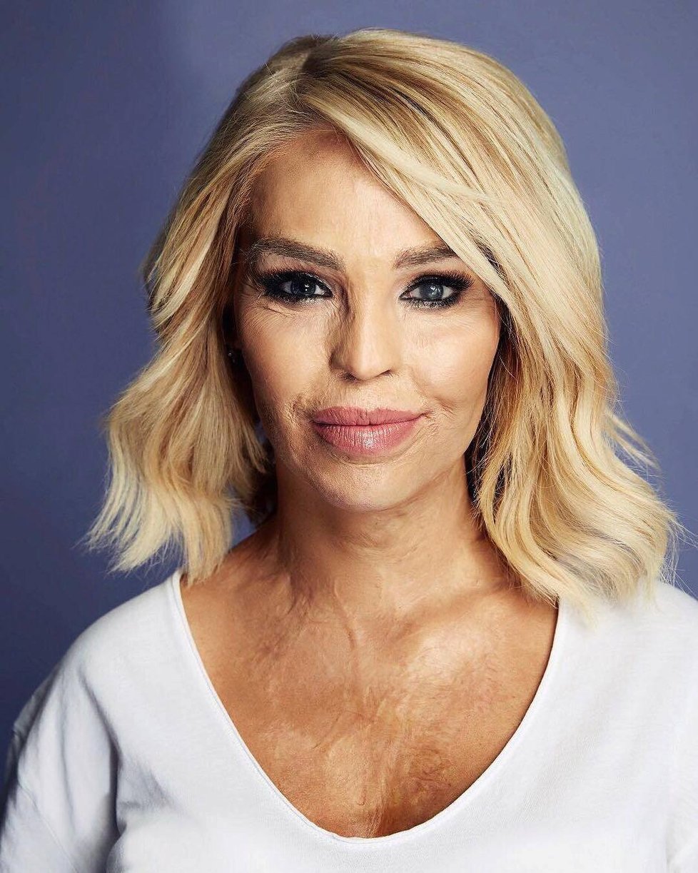 Katie Piper