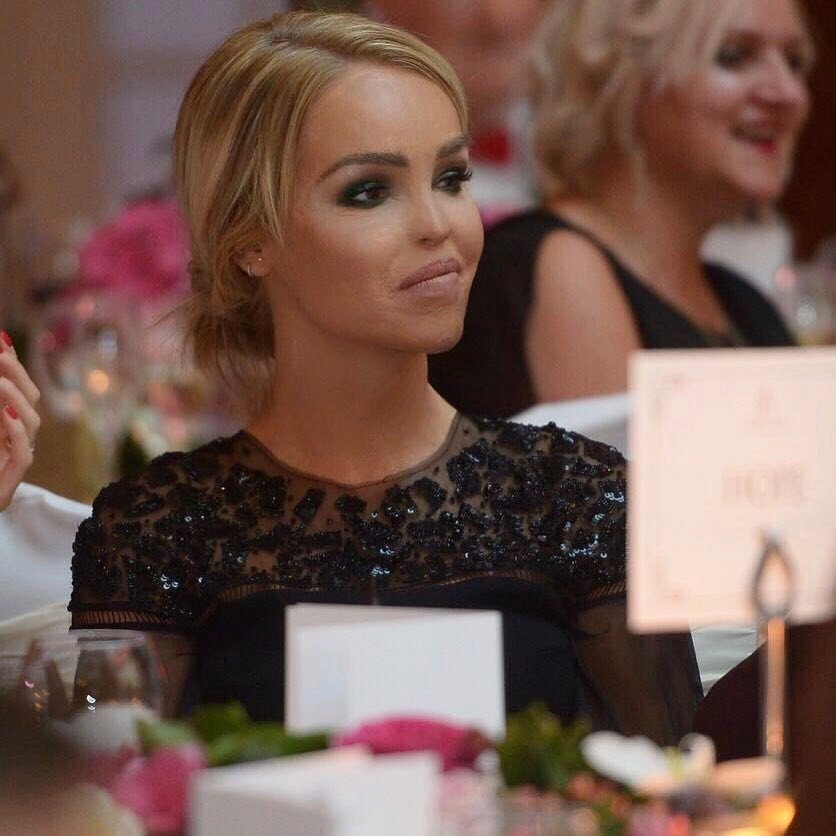 Katie Piper