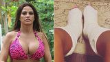 Sexbomba Katie Price si krutě zlomila obě nohy! Čeká ji invalidní vozík?