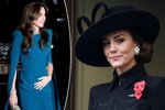 Co už se ví o operaci břicha Kate Middletonové?