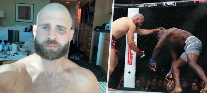 MMA bojovník Jiří Procházka obratem šokoval Vegas a... Ukázal tělo po pekelné bitvě! MMA bojovník Jiří Procházka obratem šokoval Vegas a... Ukázal tělo po pekelné bitvě!
