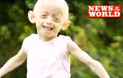 Ashanti (7): Uvězněná v těle devadesátileté babičky!