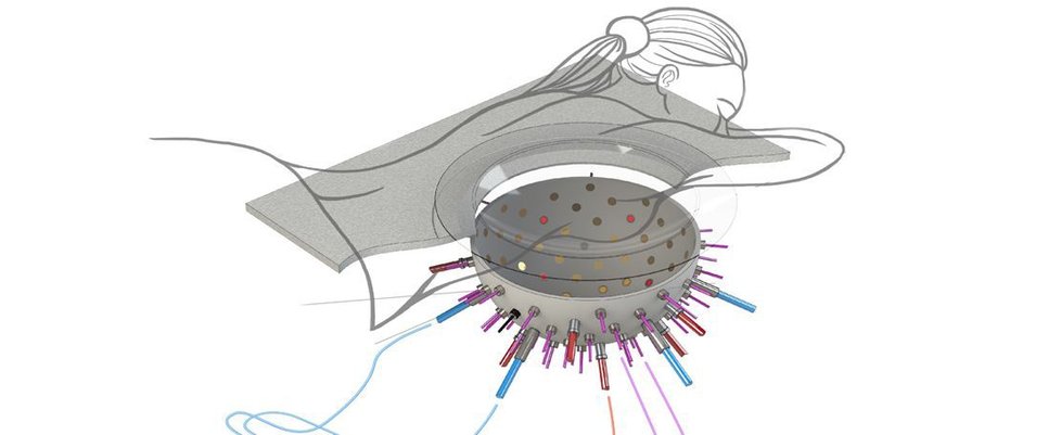 Zařízení ve tvaru misky o průměru asi 25 cm rotuje kolem prsu pacientky. Každou desetinu sekundy osvětlí prsní tkáň baterií laserových děl a zaznamená vzniklou tlakovou vlnu pomocí až 512 ultrazvukových senzorů.