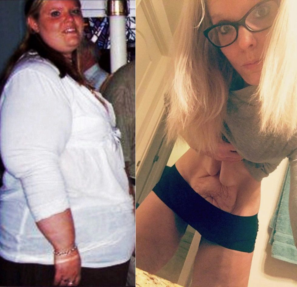 Joanna zhubla devětaosmdesát kilogramů během pouhých tří let.