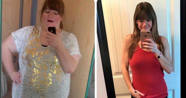 Šokující proměna! Jak to vypadá, když žena zhubne o 125 kilo?