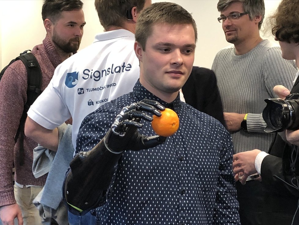 Jakub se narodil s chybějící částí paže, teď má robotickou protézu. Jeho život se s ní významně usnadnil.