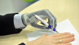 Nejmodernější verze bionické protézy od firmy TouchBionics stojí 1,5 milionu korun.