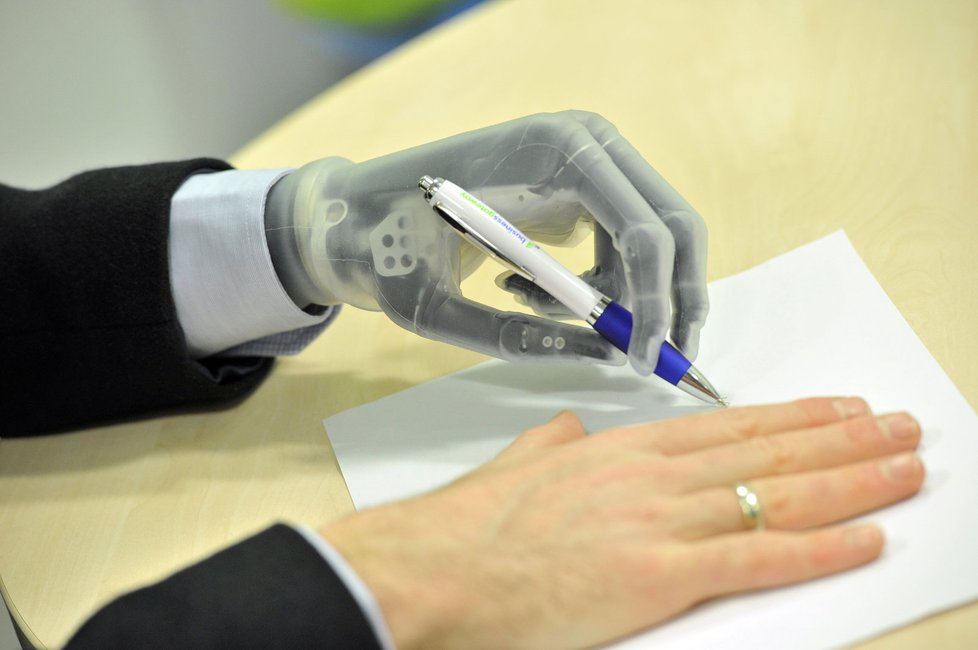 Nejmodernější verze bionické protézy od firmy Touch Bionics stojí 1,5 milionu korun.