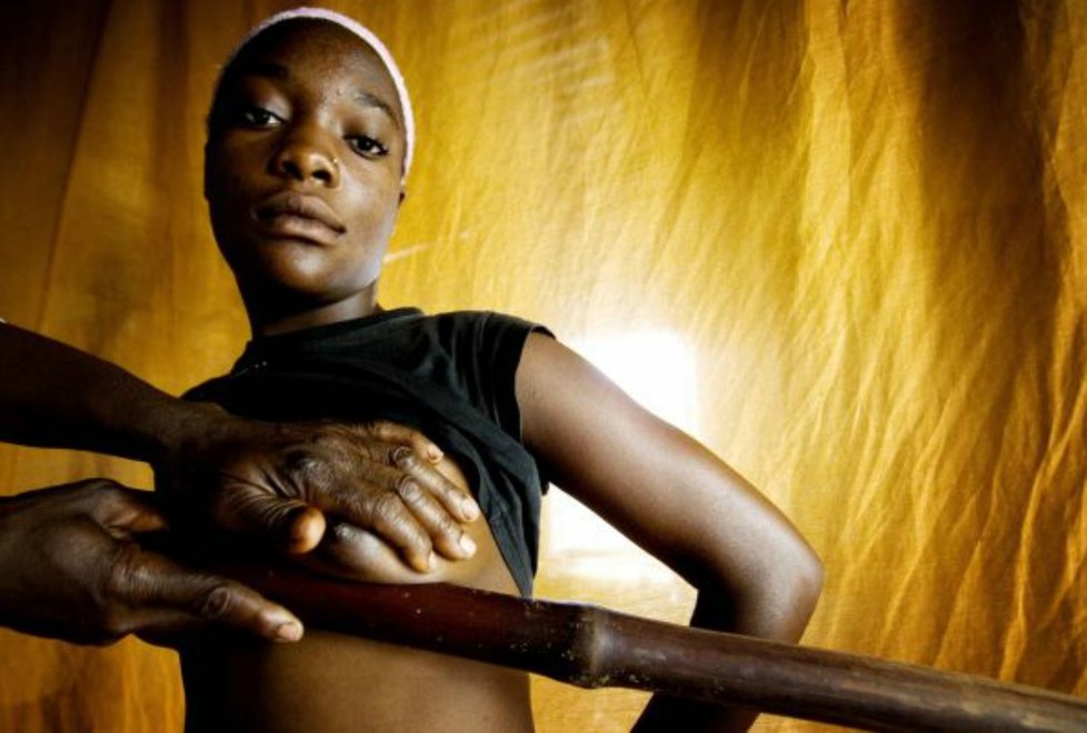 V Africe dívkám a holčičkám místo antikoncepce žehlí prsa.