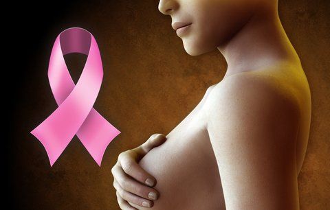 Máte v rodině rakovinu prsu? Na 70 procent hrozí i vám, tvrdí lékař