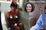 Vlasta Stoličková si vyslechla hrozivou diagnózu – rakovina prsu. Nechala si proto ňadra uříznout po vzoru Angeliny Jolie.