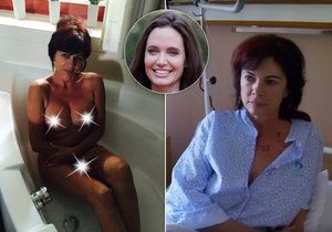 Vlasta Stoličková si vyslechla hrozivou diagnózu – rakovina prsu. Nechala si proto ňadra uříznout po vzoru Angeliny Jolie.