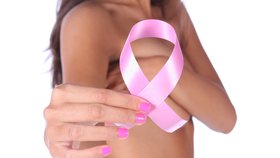 Rakovina prsu: Aspirin sníží riziko úmrtí o 50 %