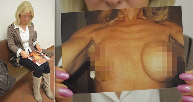 Měla jsem mít prsa jak mladá holka, pláče Jaroslava (62) po zpackané plastické operaci