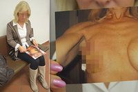 Měla jsem mít prsa jak mladá holka, pláče Jaroslava (62) po zpackané plastické operaci