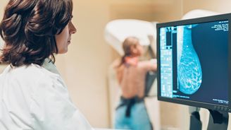 Zdravá prsa: Mamograf versus ultrazvuk