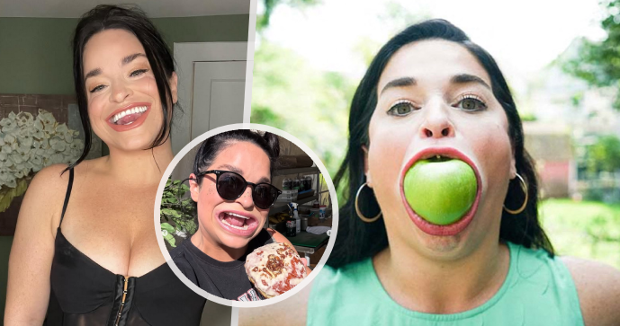 Influencerka Samantha Ramsdellová s obří pusou.