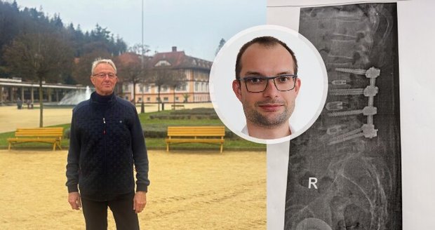 Lékař Vlastimil Pustina prodělal náročnou operaci, díky rehabilitaci je ale zase plně fit.