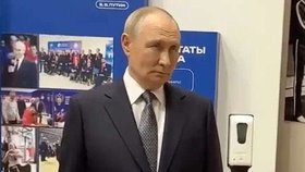 Putinova bolavá nateklá ruka