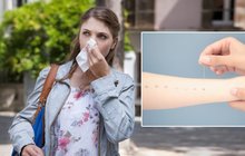 6 mýtů o alergiích: Není to jen rýma