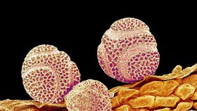 Pylová částice pod mikroskopem