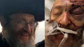 Nechutný antisemitský útok: Rabínovi zasekl nůž do hlavy, muž nyní zemřel.