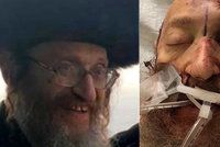 Nechutný antisemitský útok: Rabínovi zasekl nůž do hlavy, muž nyní zemřel