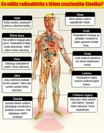 Co způsobuje lidskému tělu ozáření?