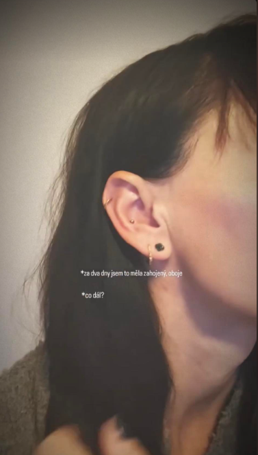 Radka Třeštíková ukázala dva nové piercingy. „Co dál?“ ptá se.