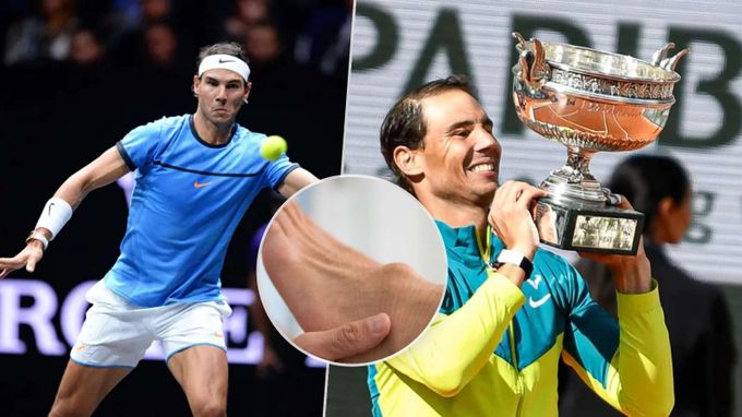 Tenisový titán Nadal skrýval celou kariéru hrůznou bouli: S tímhle dobyl svět Tenisový titán Nadal skrýval celou kariéru hrůznou bouli: S tímhle dobyl svět
