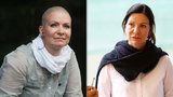 Anna K. a návrat rakoviny prsu: Jak její situaci hodnotí experti? 
