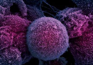 Buňka rakoviny