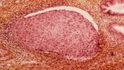 Cytologie: Co vyšetření odhalí a proč jsou výsledky důležité? Cytologie: Co vyšetření odhalí a proč jsou výsledky důležité?