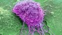 Cytologie: Co vyšetření odhalí a proč jsou výsledky důležité? Cytologie: Co vyšetření odhalí a proč jsou výsledky důležité?