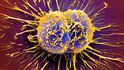 Cytologie: Co vyšetření odhalí a proč jsou výsledky důležité? Cytologie: Co vyšetření odhalí a proč jsou výsledky důležité?