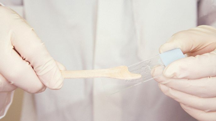Cytologie: Co vyšetření odhalí a proč jsou výsledky důležité? Cytologie: Co vyšetření odhalí a proč jsou výsledky důležité?