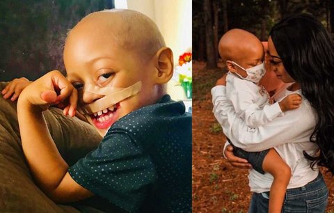 Malý hrdina svůj život vybojoval, rakovina mu ale vzala horní ret i vlasy!