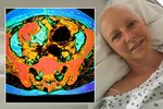 Ivana onemocněla zákeřnou rakovinou vaječníků