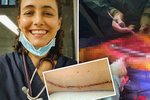 Studentce medicíny Kristě odhalili pražští lékaři nádor: Kvůli rakovině jí sebrali stehenní kost: