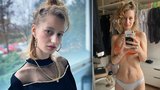 Vánoce  krásné fotografky Lucie (28) s rakovinou: Štědrý den asi probrečím!