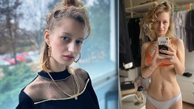 Vánoce  krásné fotografky Lucie (28) s rakovinou: Štědrý den asi probrečím!