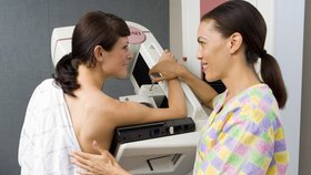 Vyšetření u mamografu je v případě rakoviny prsu nezbytné, léčba rakoviny však složitá: Pro pacientky, ale i pacienty s různými rakovinovými nálezy však svítají nové naděje (ilustrační foto)