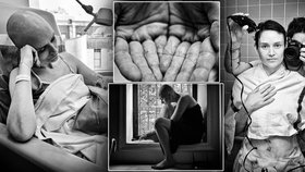 Fotil svou umírající ženu do poslední chvíle: Rakovina v deseti obrazech