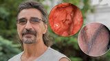 Rakovina vzala Zdeňkovi čelist, lícní kost, kus jazyka: Přežil a lékaři mu vrátili tvář!