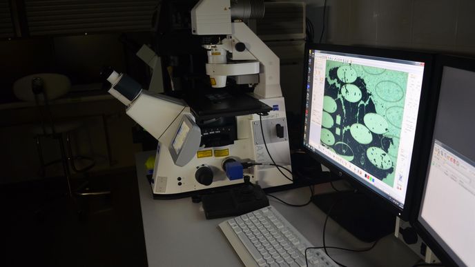 Přístroje, monitory a mikroskopy, na kterých vědci zkoumají krev a DNA pacientů s leukémií.