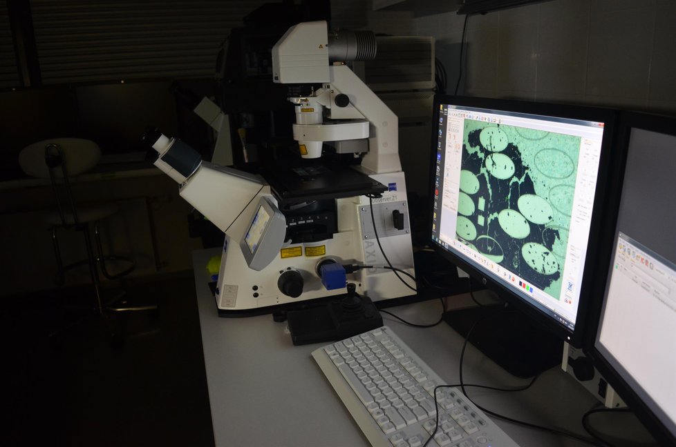 Přístroje, monitory a mikroskopy, na kterých vědci v Brně zkoumají krev a DNA pacientů s leukémií.